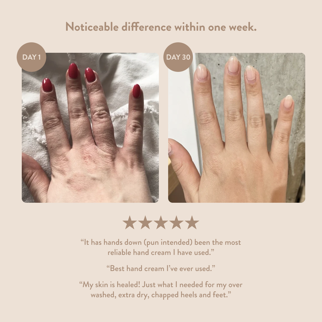 Before and after comparison of hands with red nail polish, showing skin healing over 30 days. PAUME Overnight Hand & Foot Hydration Mask
